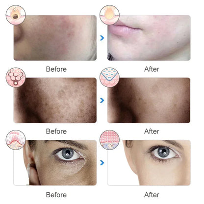 LED Red Light Therapy Face Mask